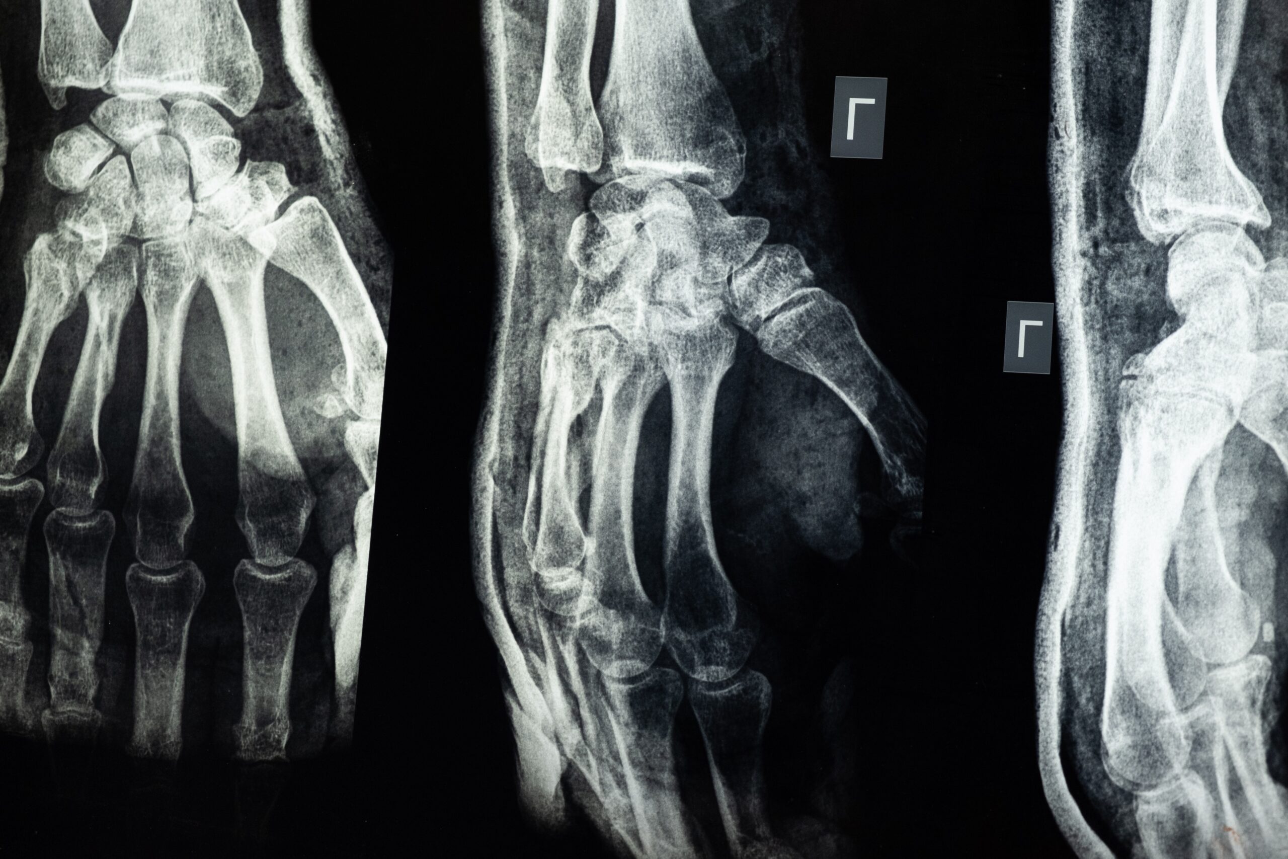 Medical imaging of an injury on the hand